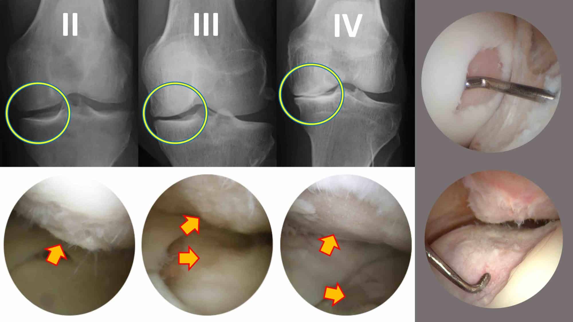 ANATOMIA DO JOELHO 10