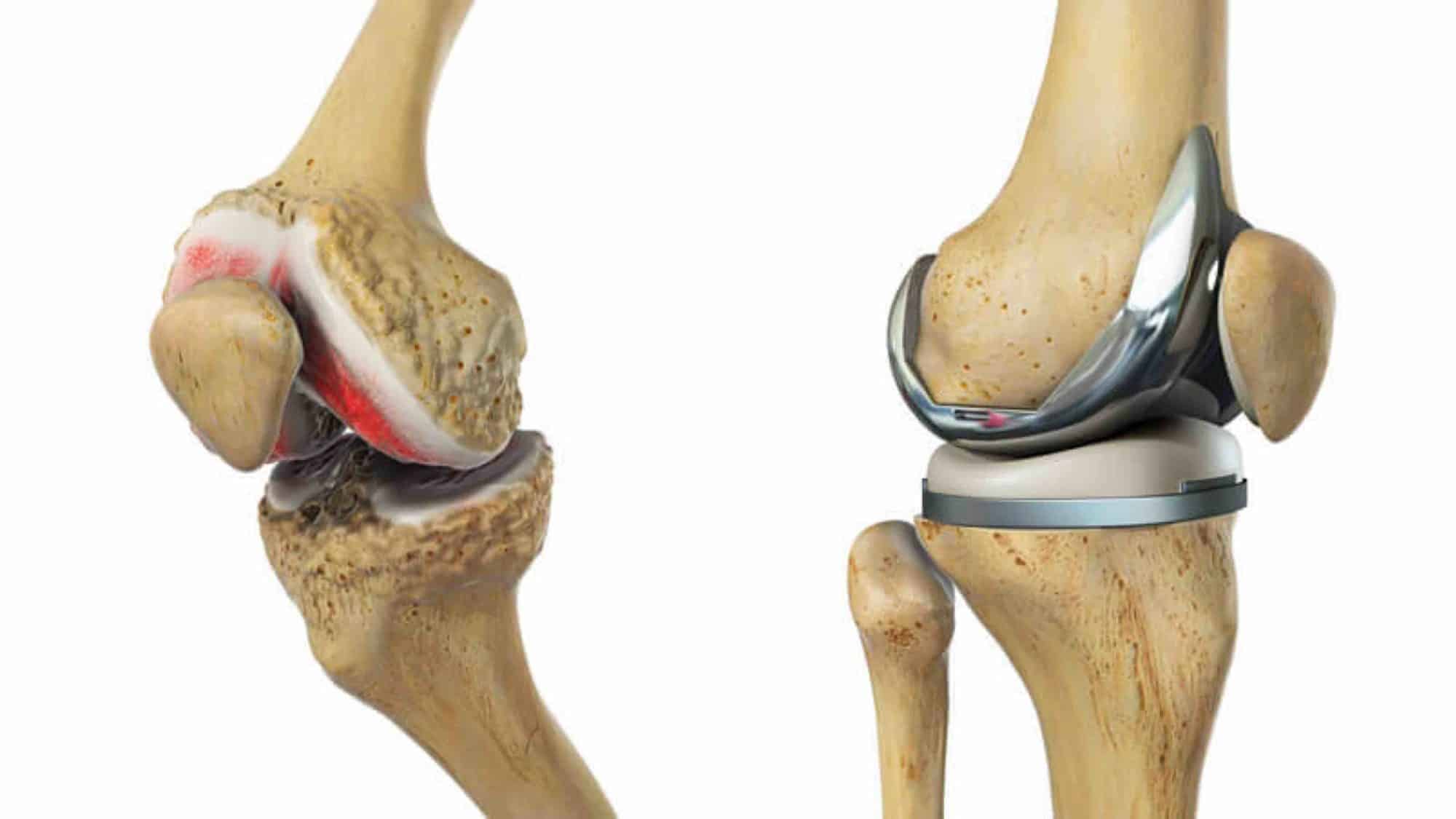 ANATOMIA DO JOELHO 8