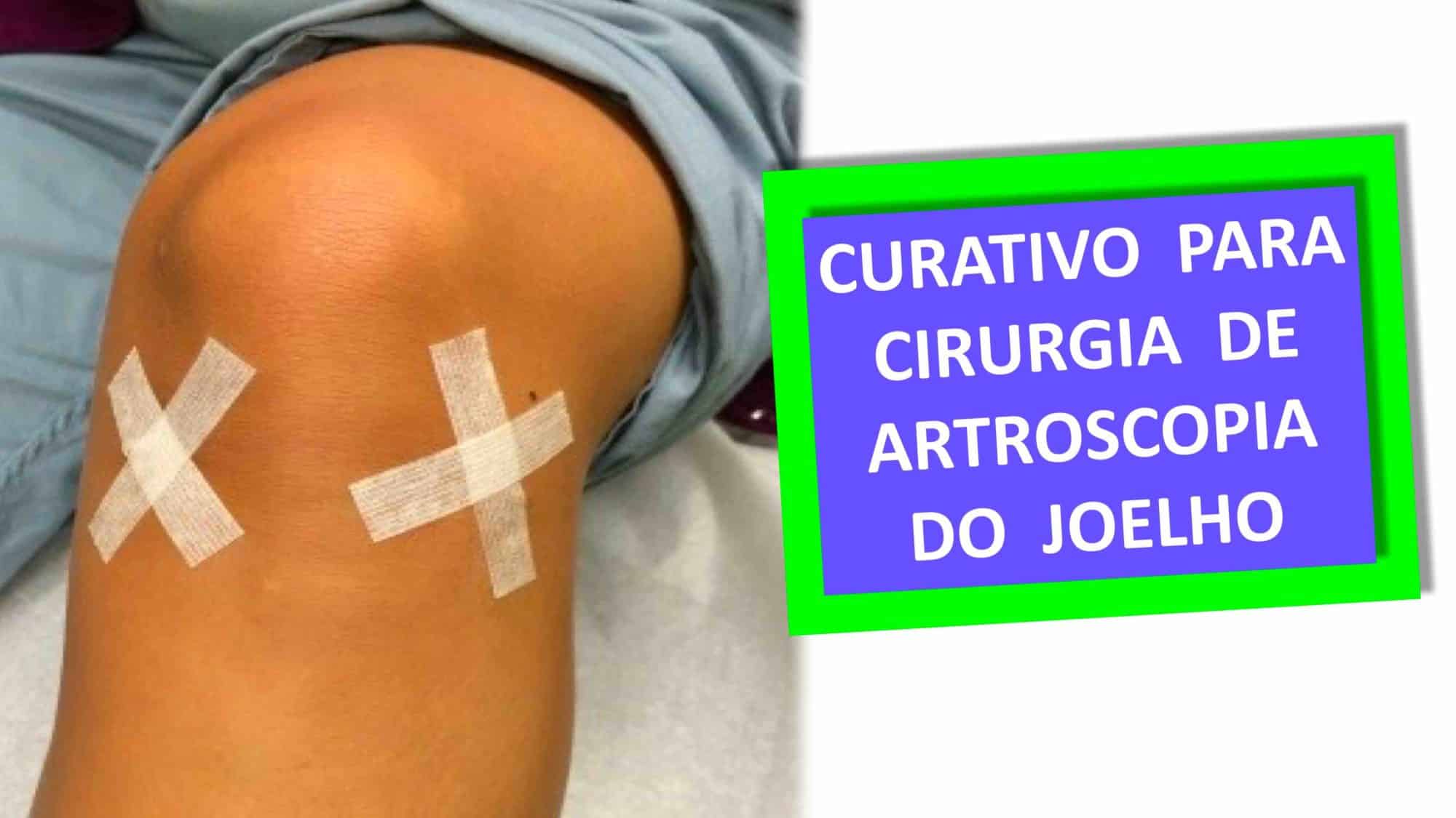 CURATIVO PARA ARTROSCOPIA DO JOELHO