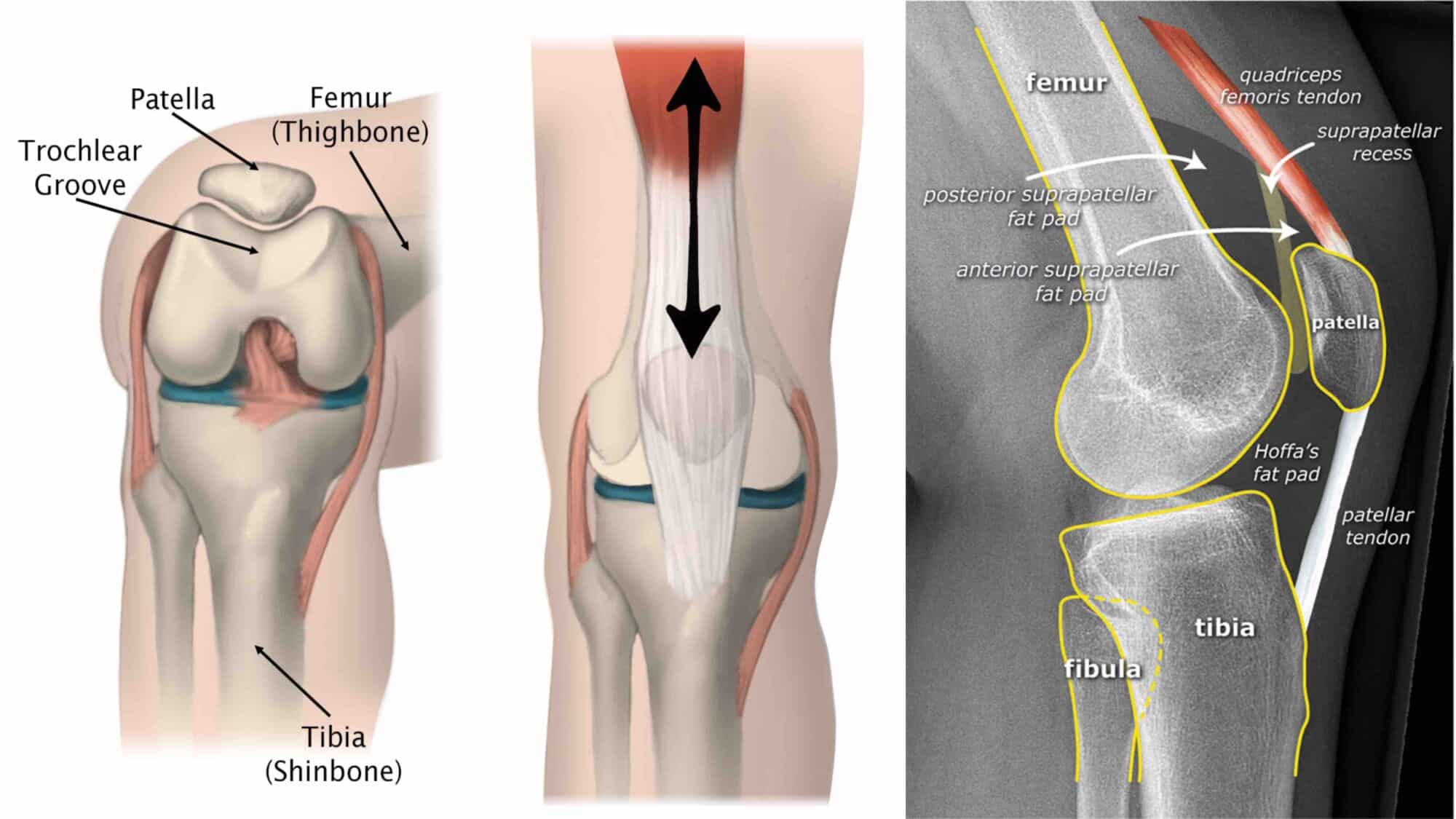 ANATOMIA DO JOELHO 18