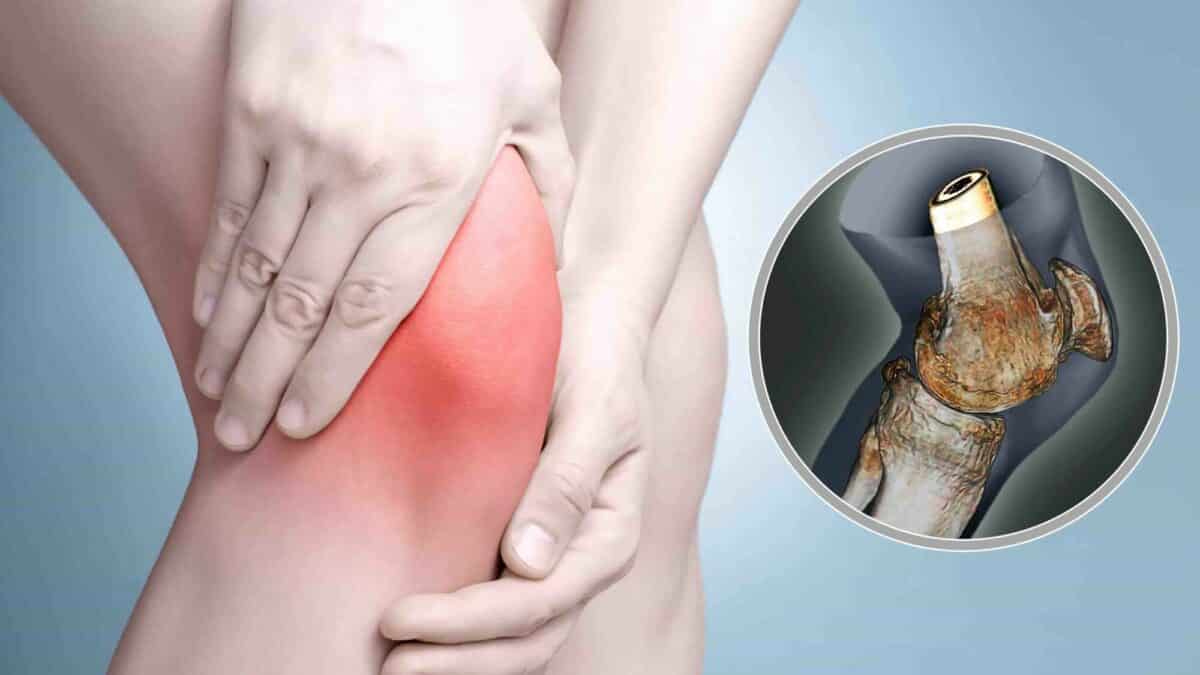 Sinais e sintomas das lesões e doenças do Joelho Clínica do Joelho