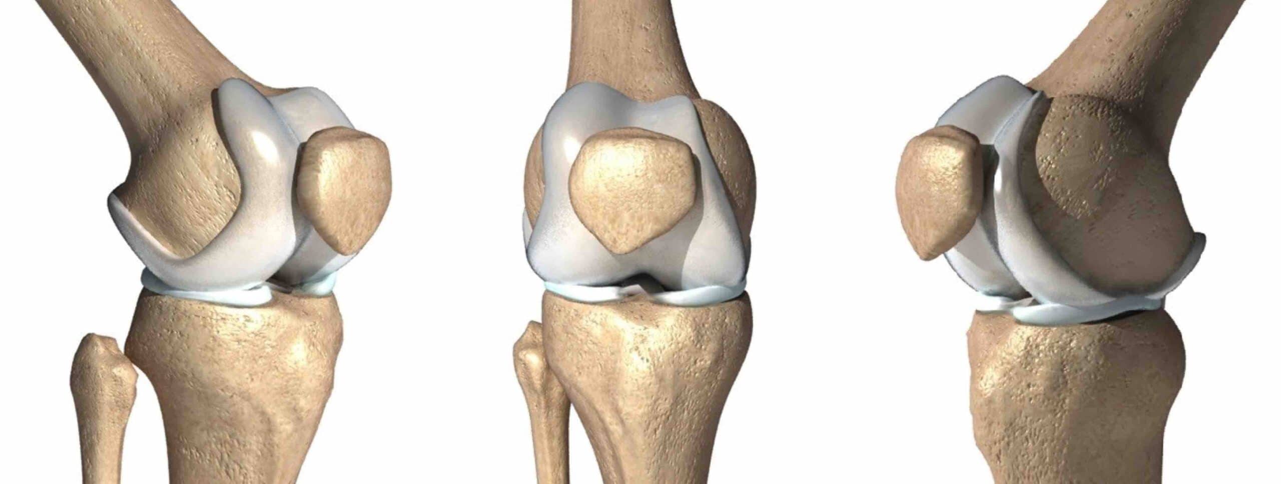 ARTICULAÇÃO PATELOFEMORAL