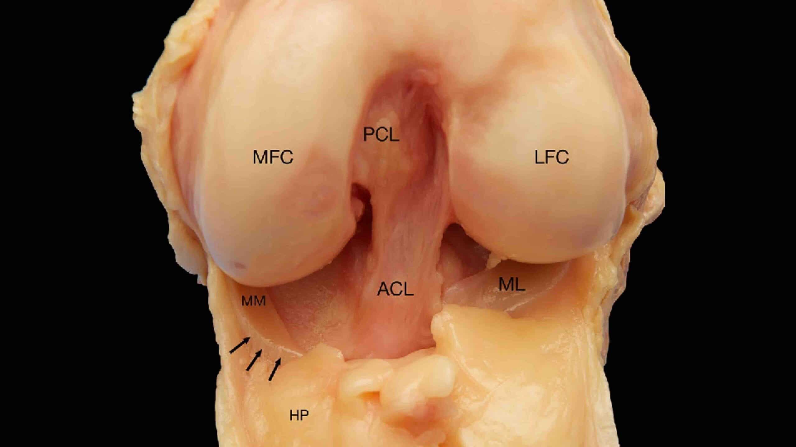 ANATOMIA DO JOELHO 23