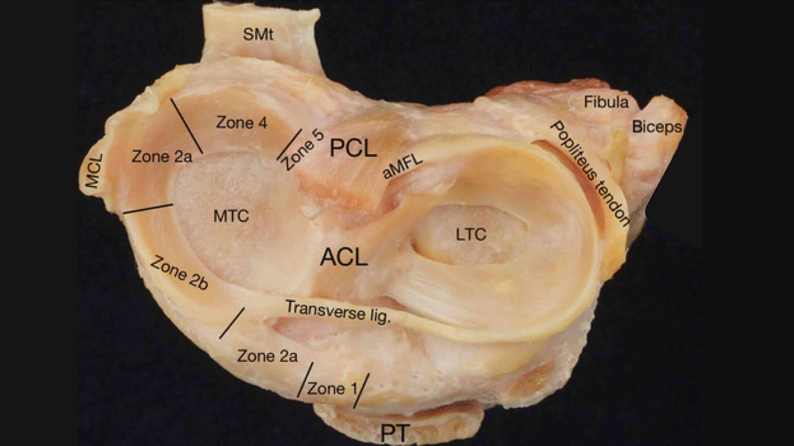 ANATOMIA DO JOELHO 24