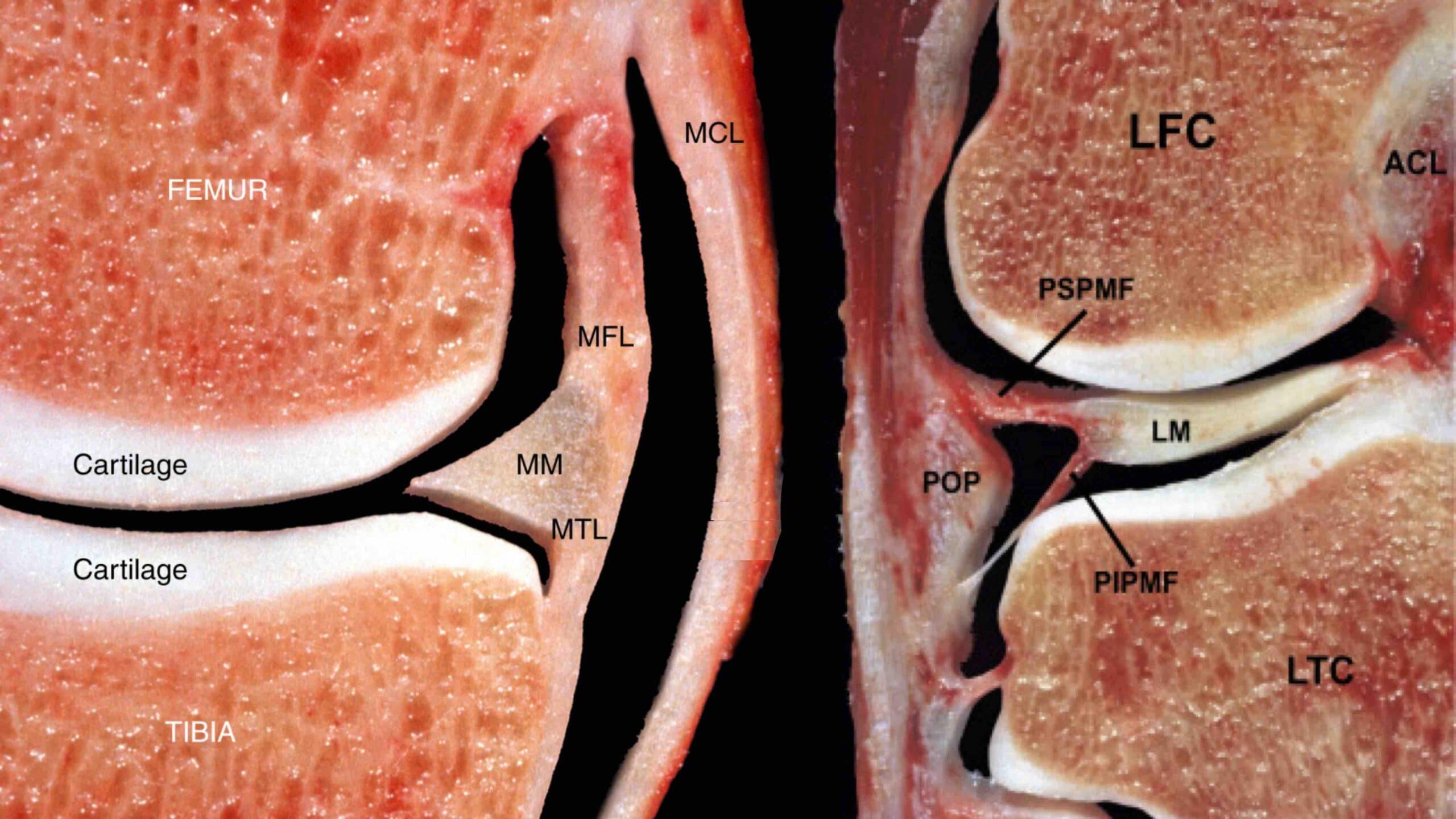 ANATOMIA DO JOELHO 25