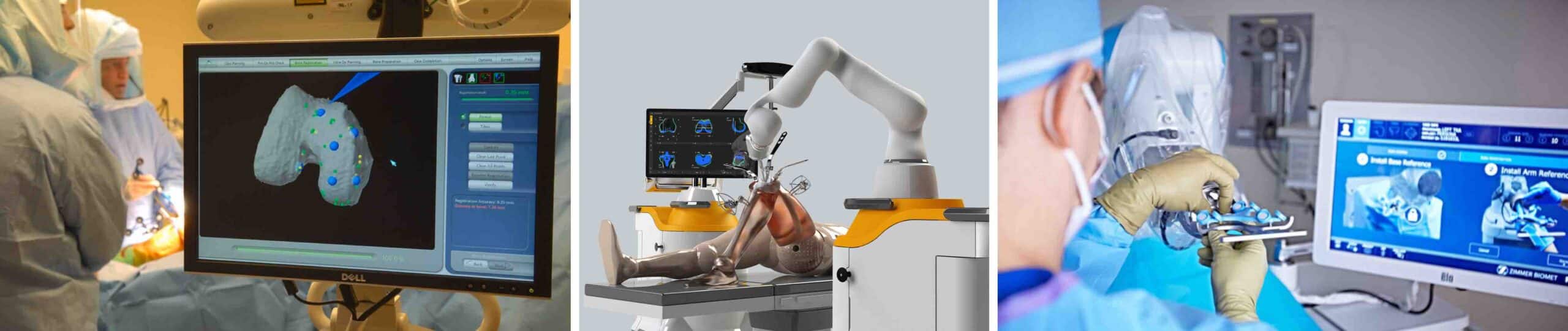 CIRURGIA ROBÓTICA JOELHO