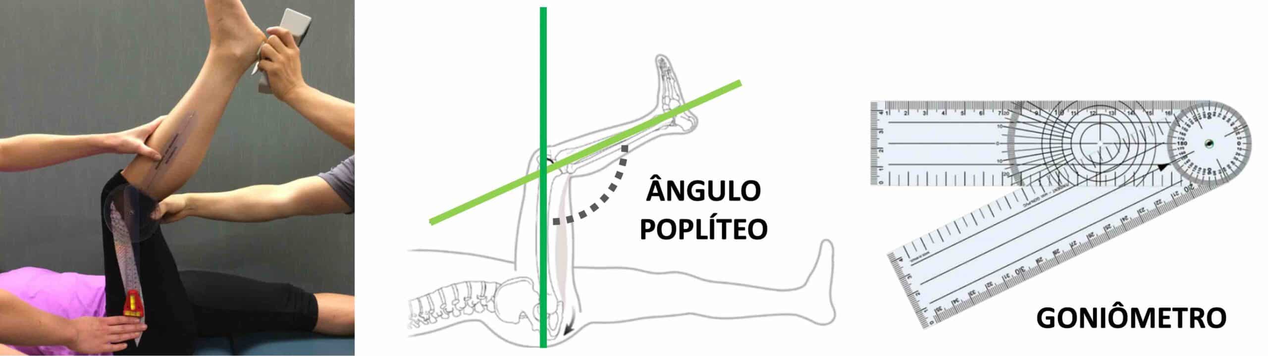 ÂNGULO POPLÍTEO - MEDIDA