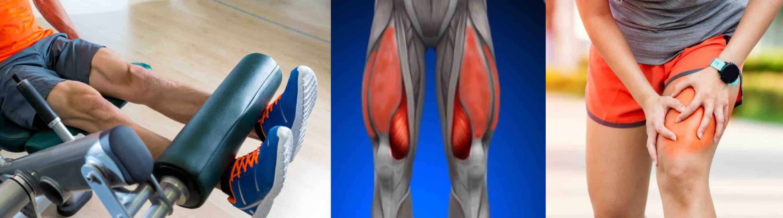 MÚSCULO QUADRÍCEPS FEMORAL