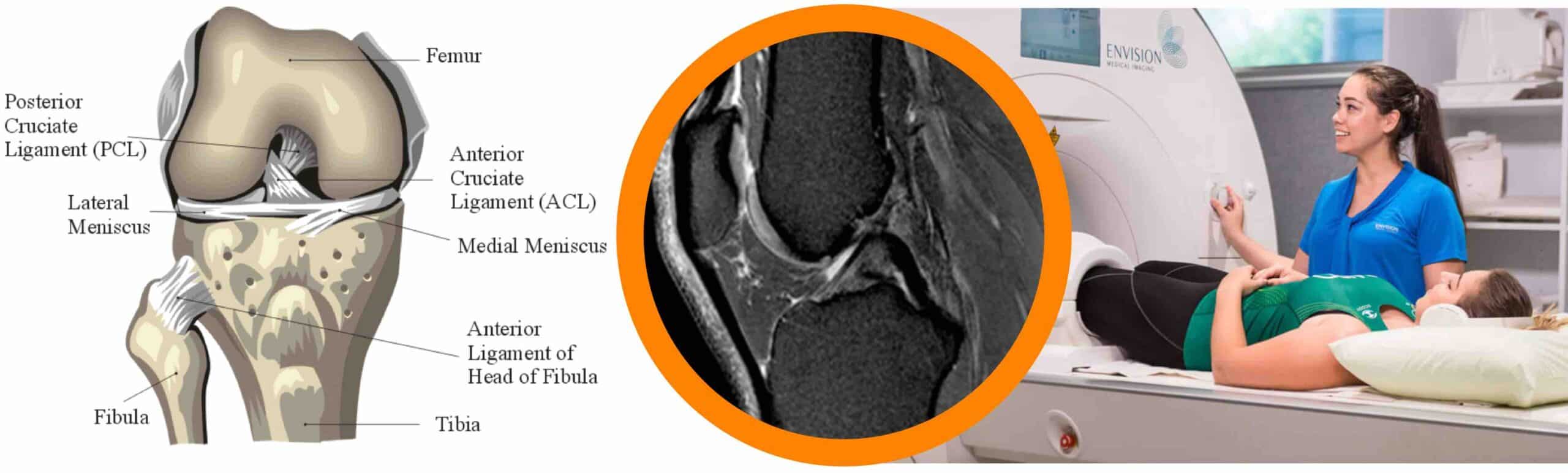 LIGAMENTOS JOELHO