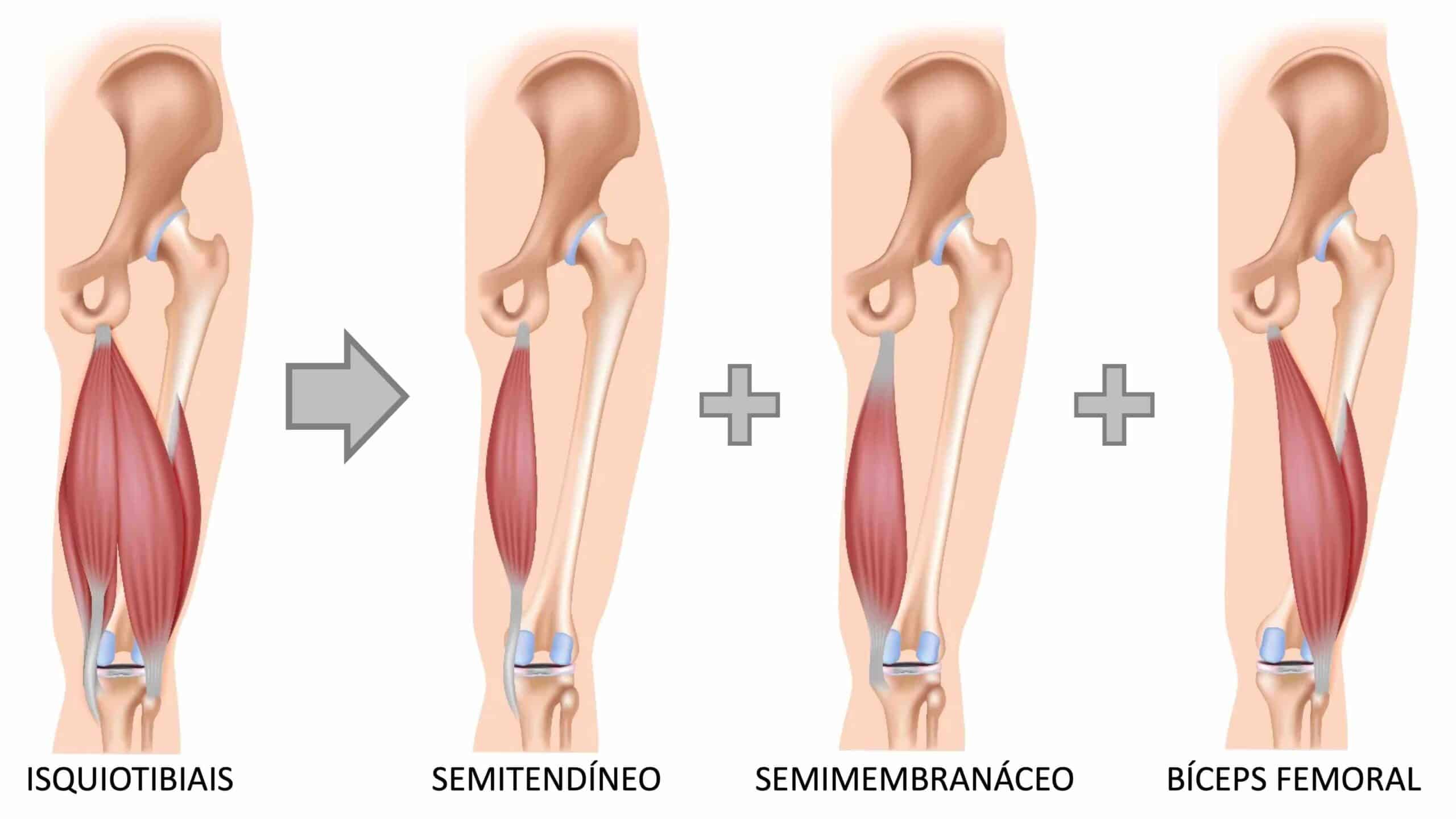 MÚSCULOS ISQUIOTIBIAIS