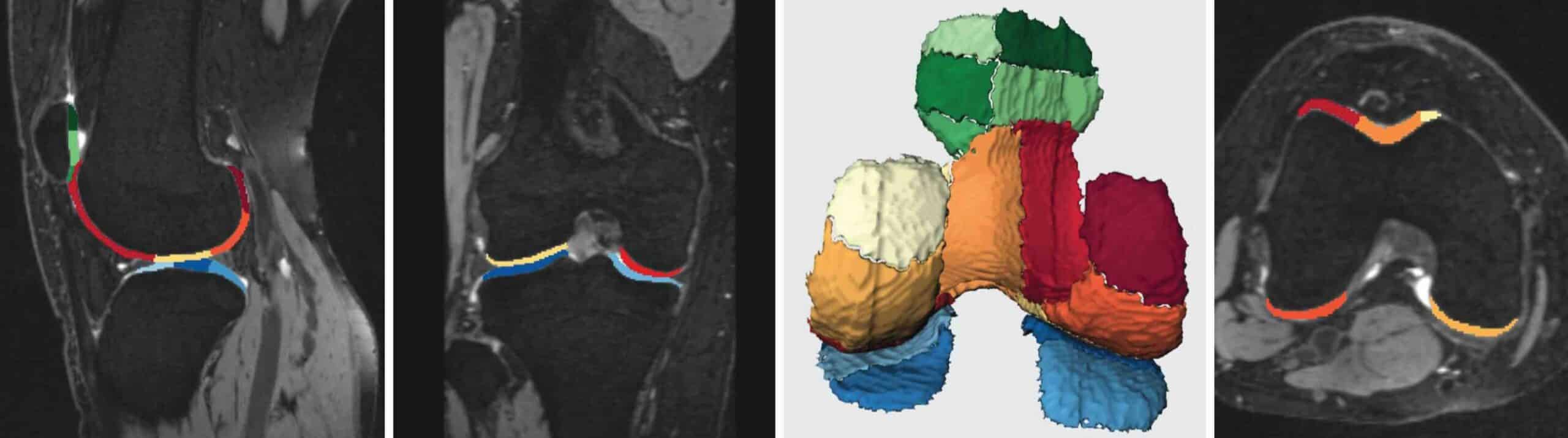 PATELOFEMORAL