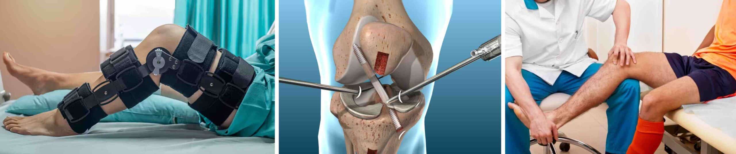 LIGAMENTO JOELHO ROMPIDO