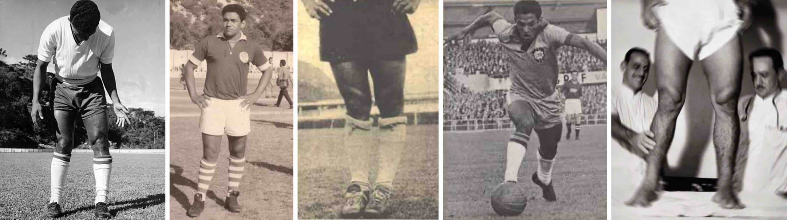 JOELHOS DO JOGADOR GARRINCHA