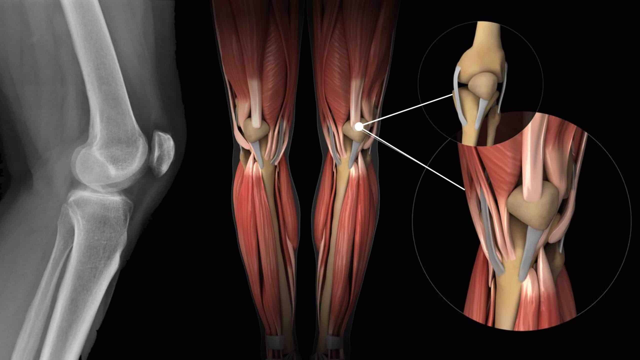 ANATOMIA DOS JOELHOS