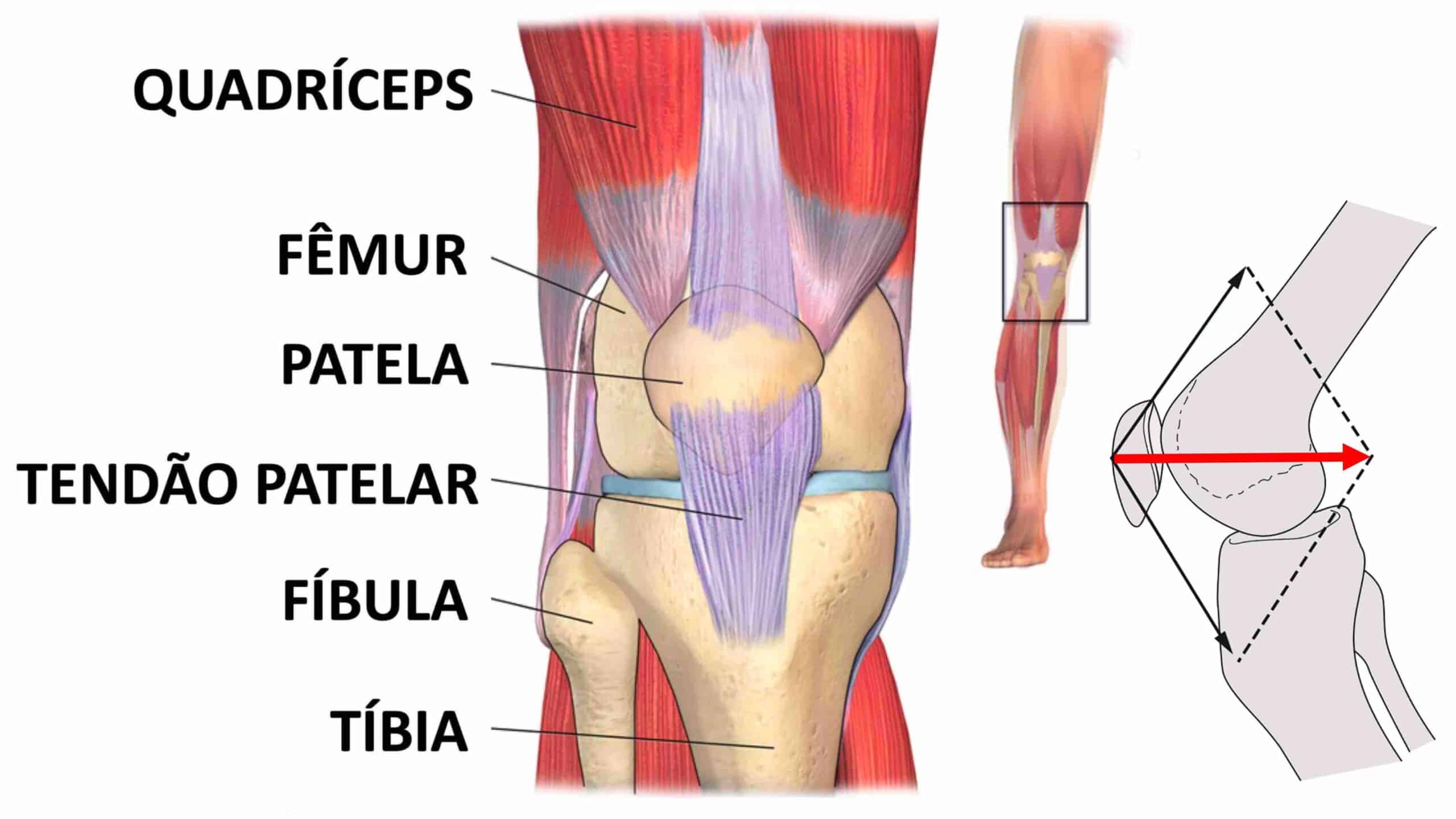 ARTICULAÇÃO PATELOFEMORAL DO JOELHO