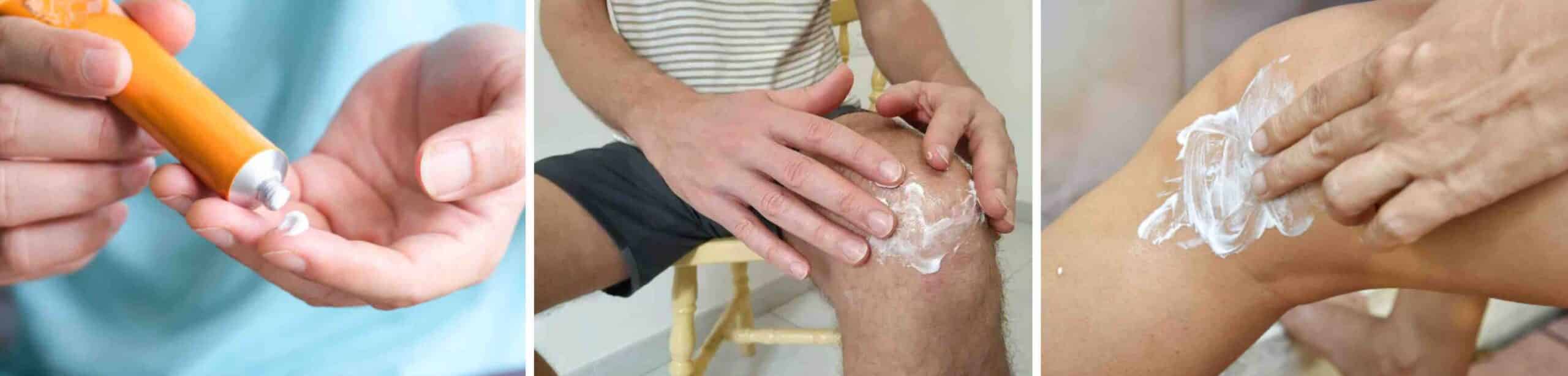 POMADA ARTROSE JOELHO POMADA ARTROSE JOELHO