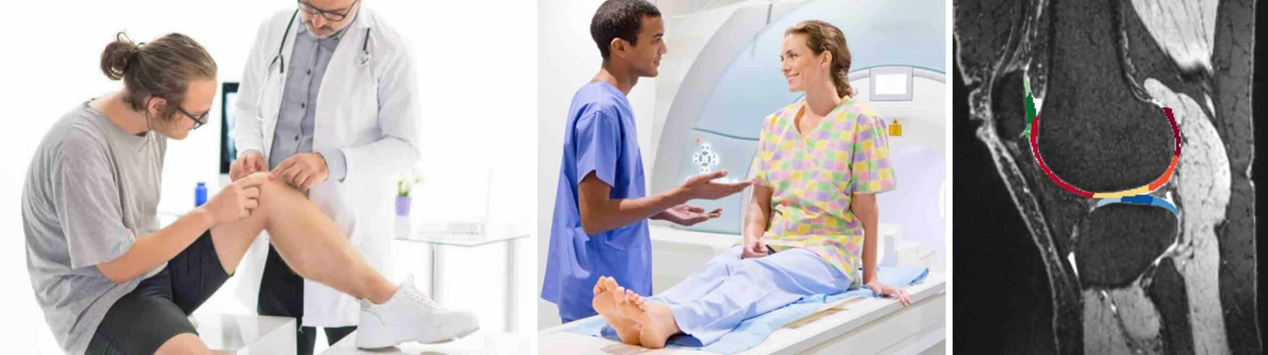 DIAGNÓSTICO DE ARTROSE NO JOELHO DIAGNÓSTICO DE ARTROSE NO JOELHO