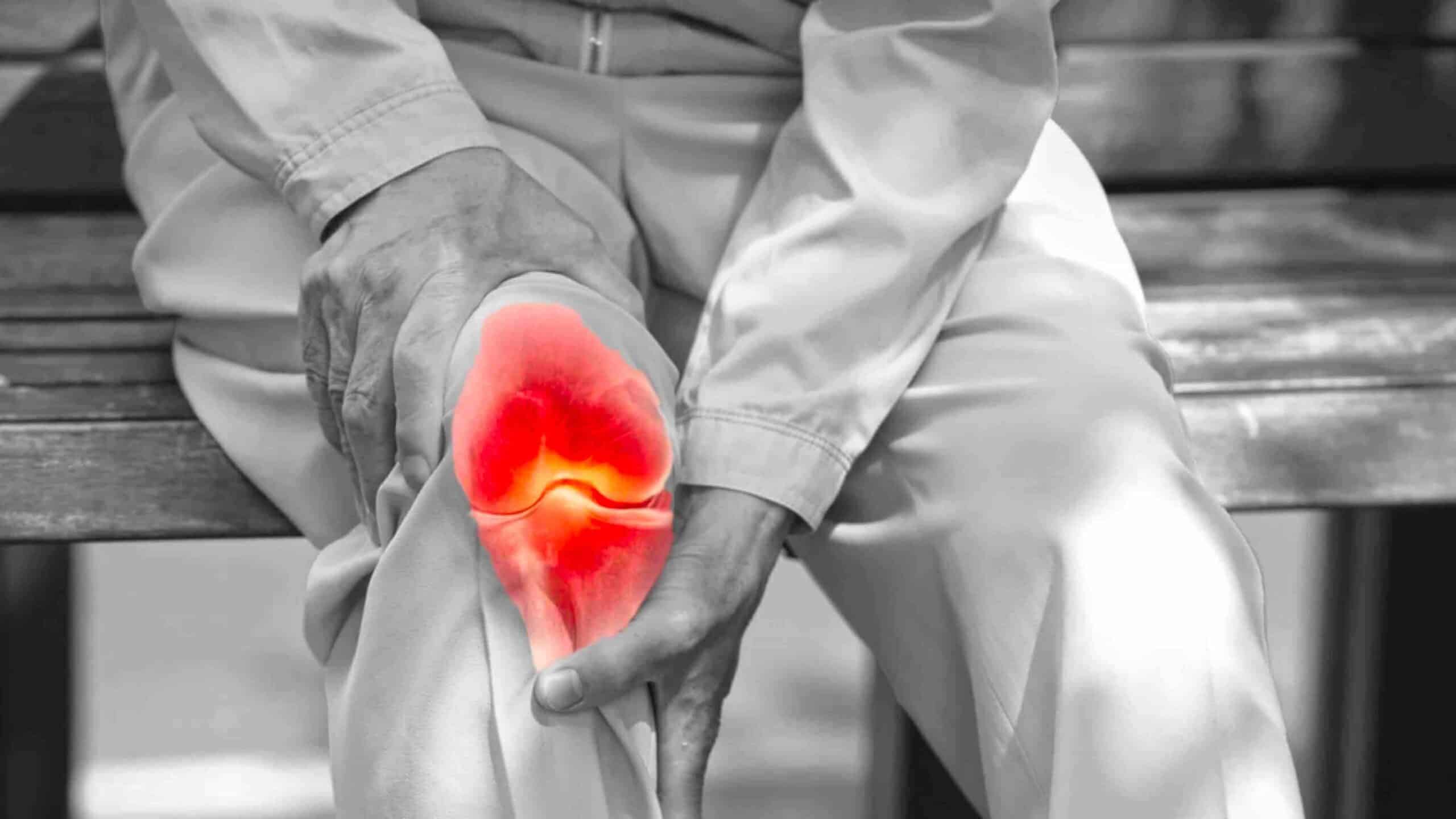 AUTOCUIDADOS PARA ARTROSE DO JOELHO AUTOCUIDADOS PARA ARTROSE DO JOELHO