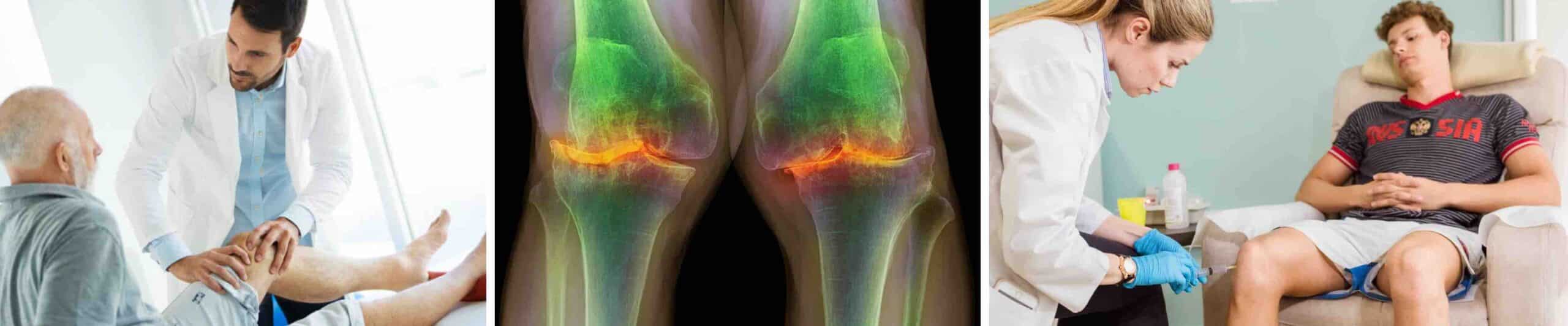 APLICAÇÃO OZÔNIO JOELHO APLICAÇÃO OZÔNIO JOELHO