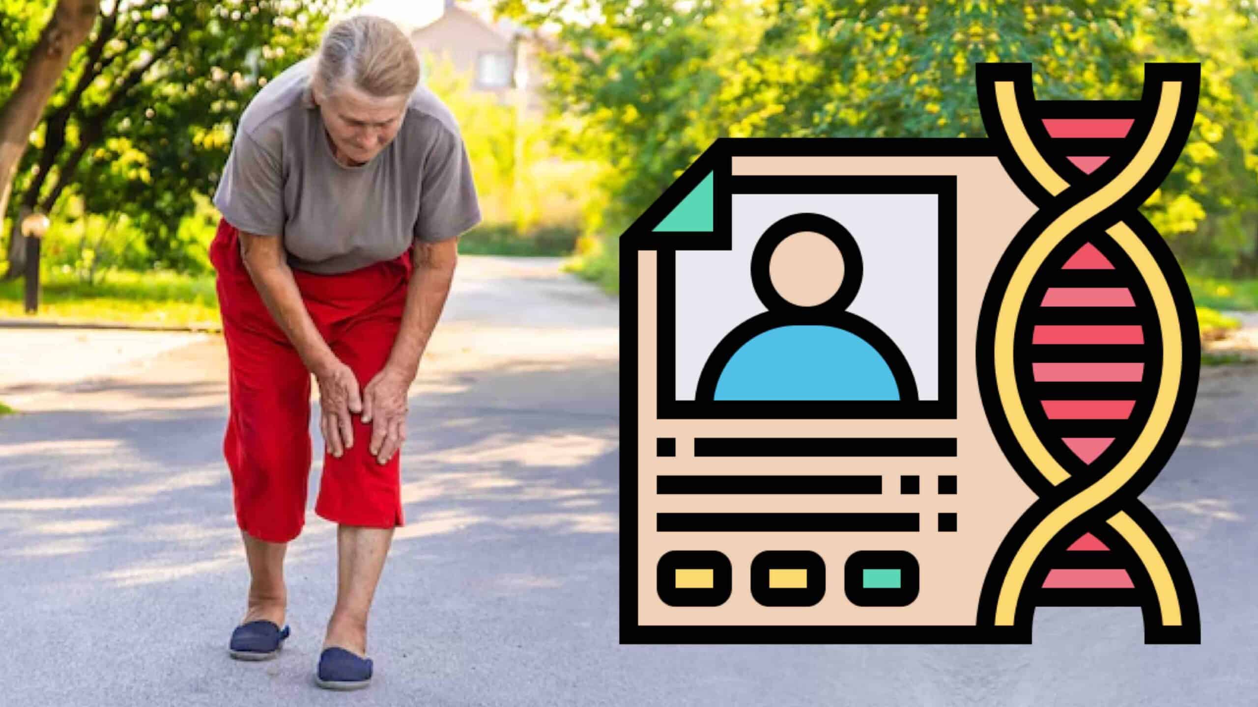 ARTROSE DO JOELHO E HISTÓRICO FAMILIAR ARTROSE DO JOELHO E HISTÓRICO FAMILIAR