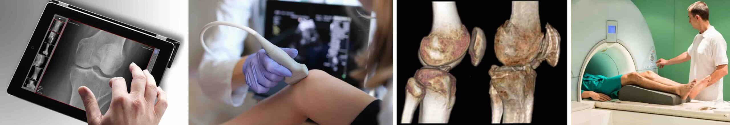 PARTES MOLES JOELHO PARTES MOLES JOELHO