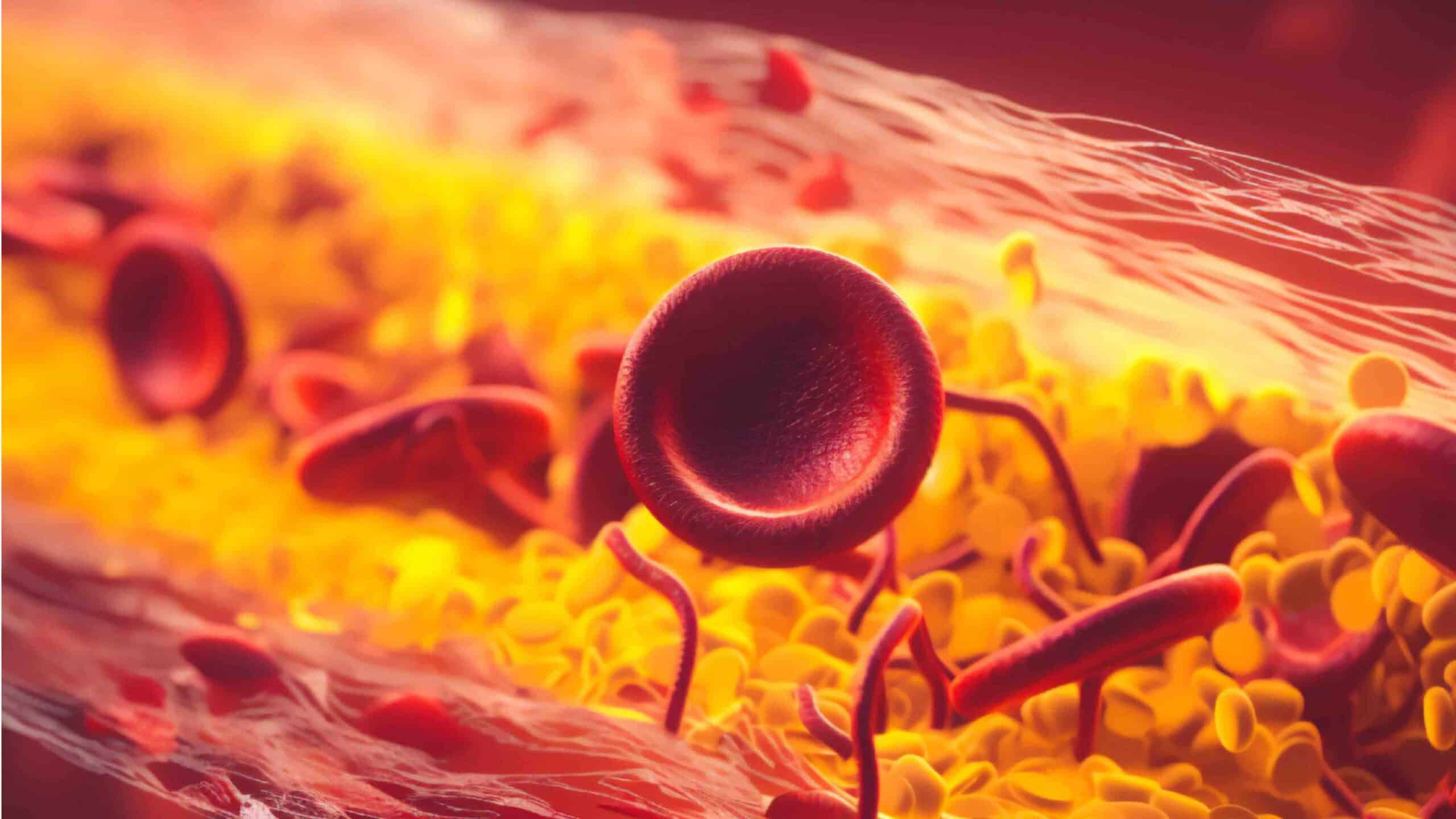 FAVISMO E OZONIOTERAPIA FAVISMO E OZONIOTERAPIA