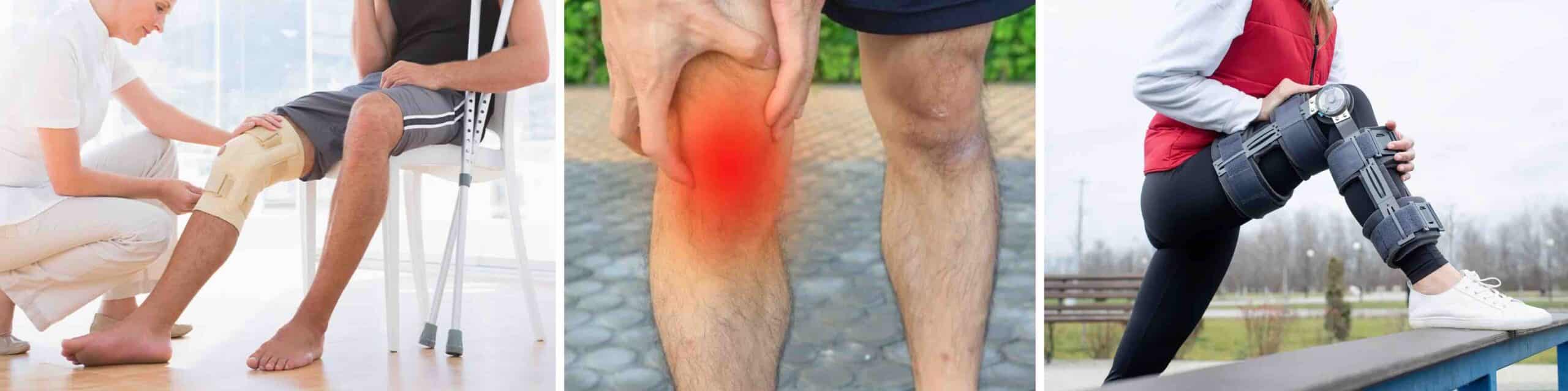 JOELHO FRATURA OSTEOCONDRAL JOELHO FRATURA OSTEOCONDRAL