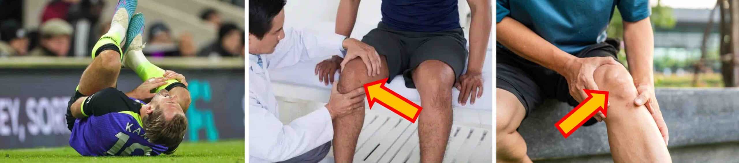 LESÃO PELLEGRINI-STIEDA LESÃO PELLEGRINI-STIEDA