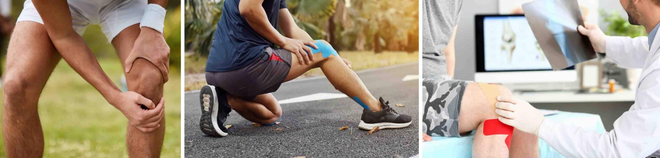 INSTABILIDADE ARTICULAÇÃO PATELOFEMORAL INSTABILIDADE ARTICULAÇÃO PATELOFEMORAL