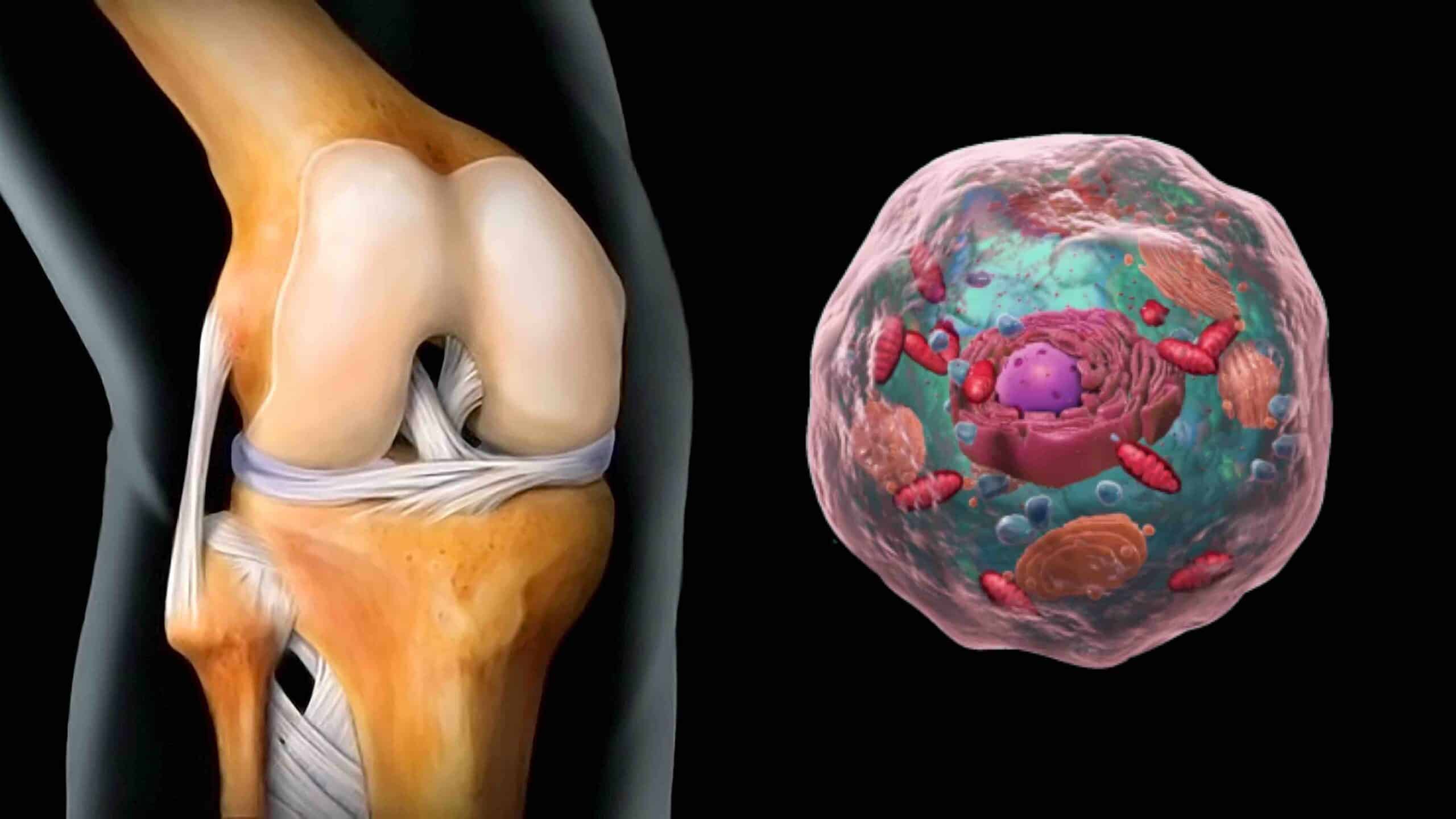 SINOVIÓCITO DO TIPO B DO JOELHO