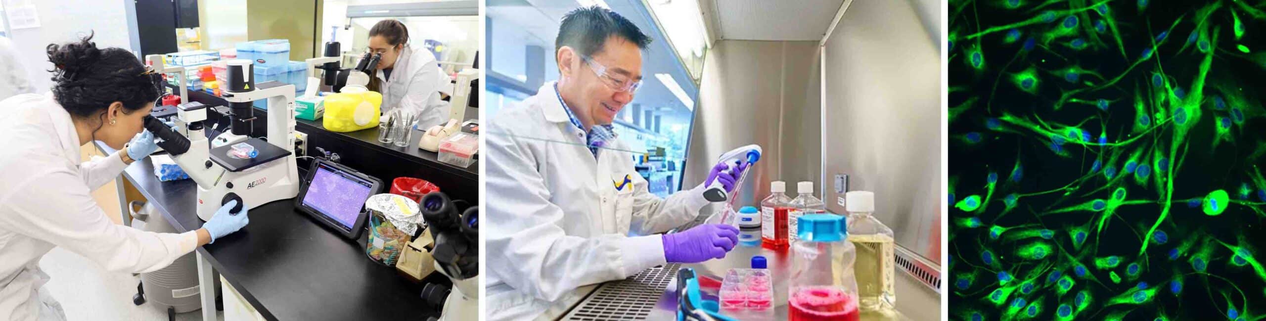 SINOVIÓCITO TIPO B JOELHO