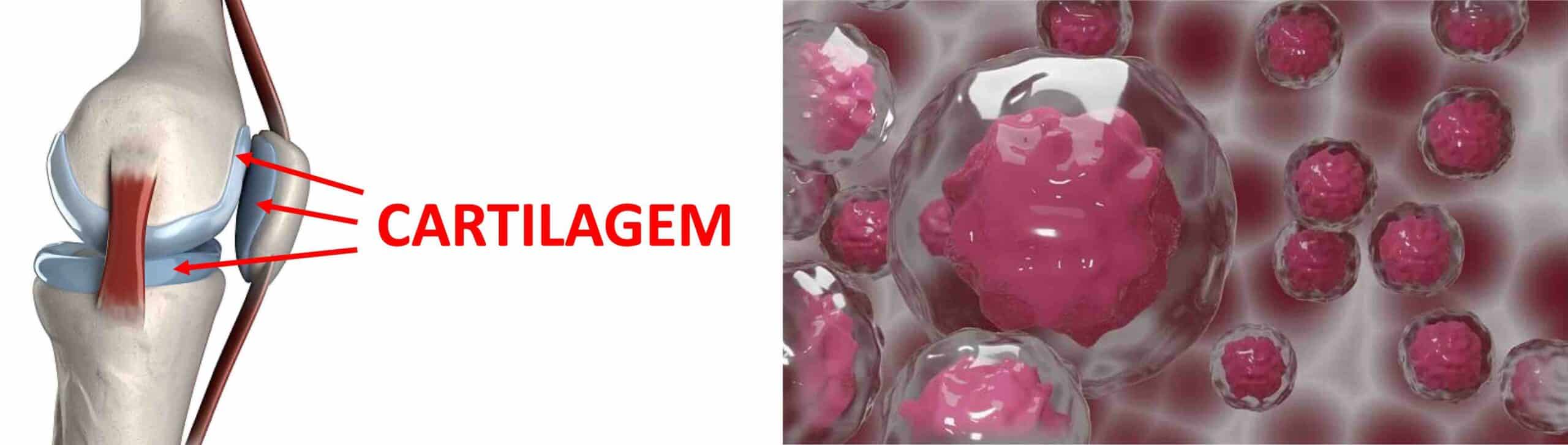FISIOLOGIA CARTILAGEM JOELHO