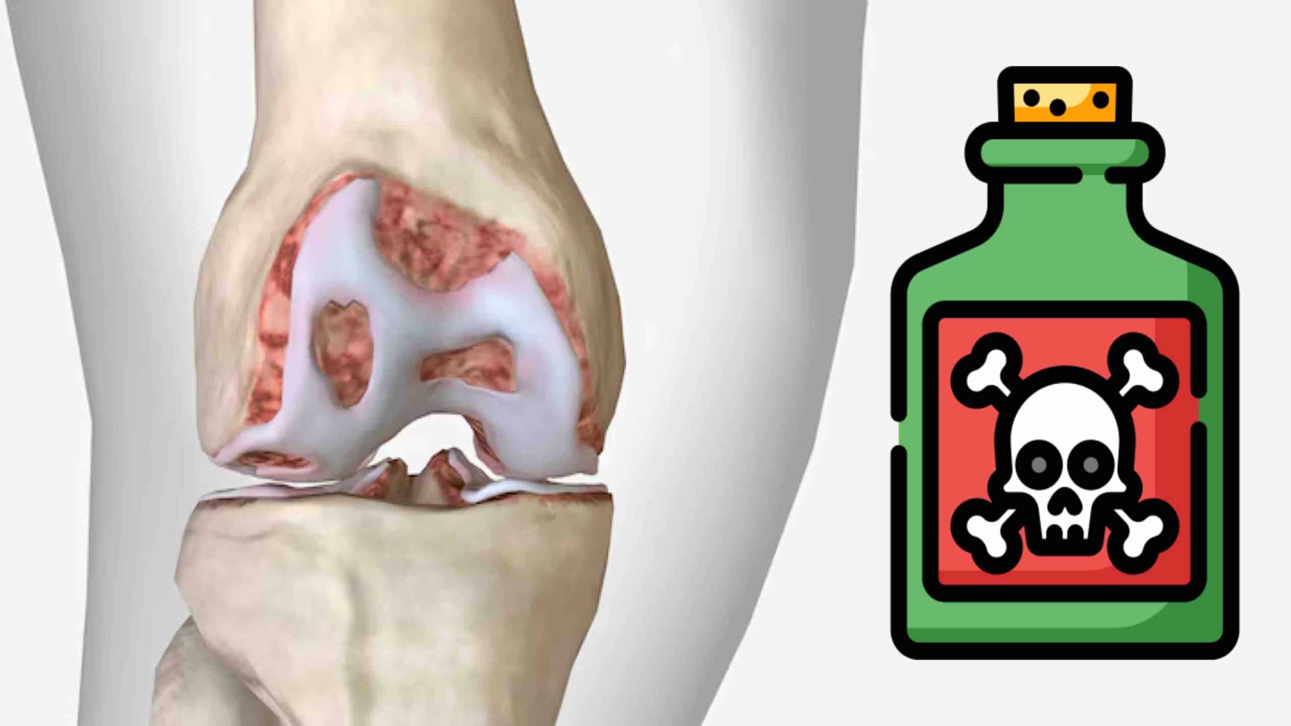 MEDICAMENTOS CONDROTÓXICOS PARA O JOELHO