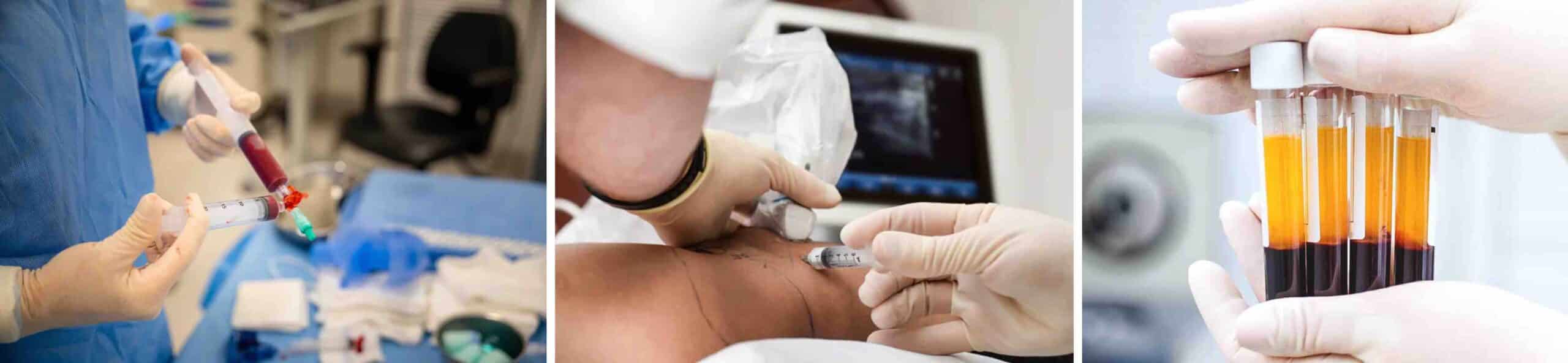 MEDICINA REGENERATIVA JOELHO MEDICINA REGENERATIVA JOELHO