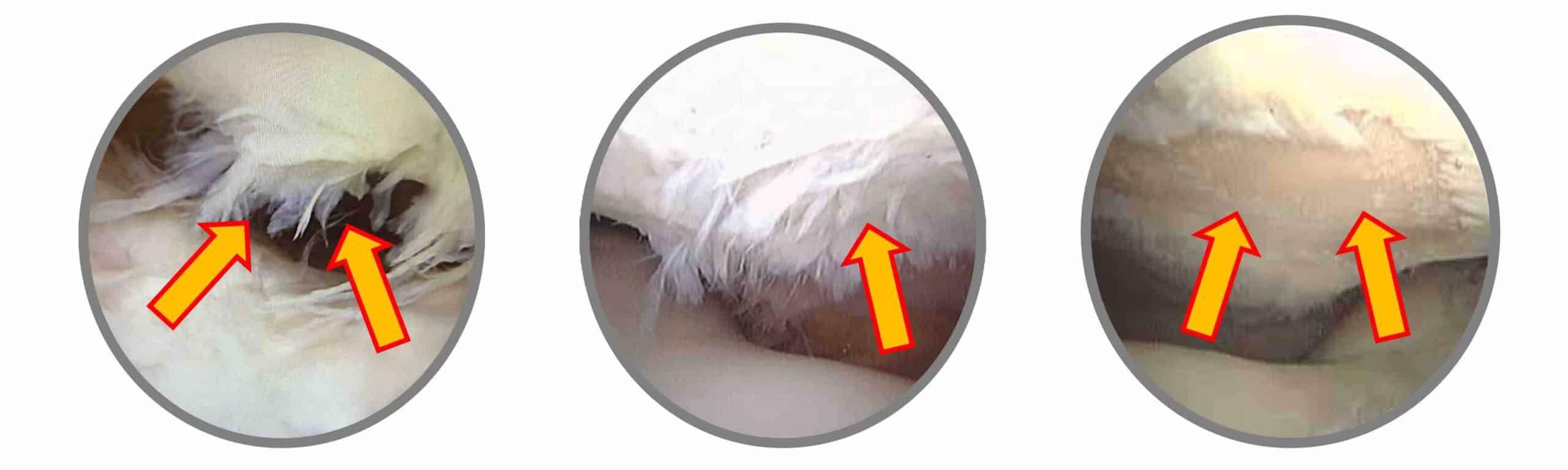 PRIMEIRO SINAL CONDROMALÁCIA