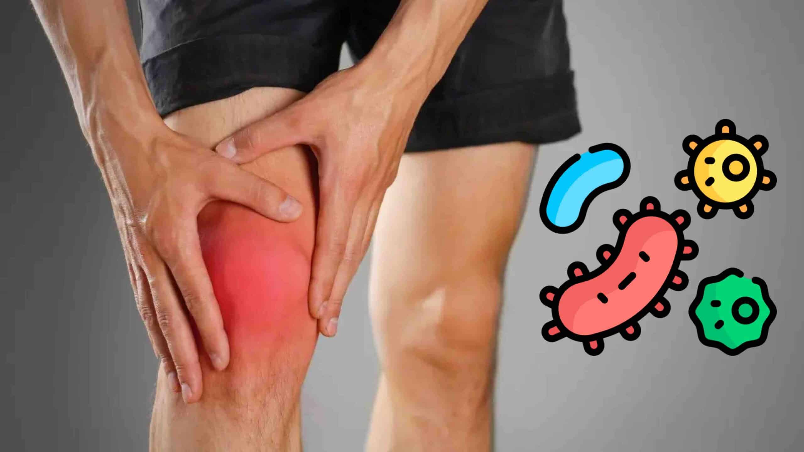 INFECÇÃO DA CARTILAGEM DO JOELHO