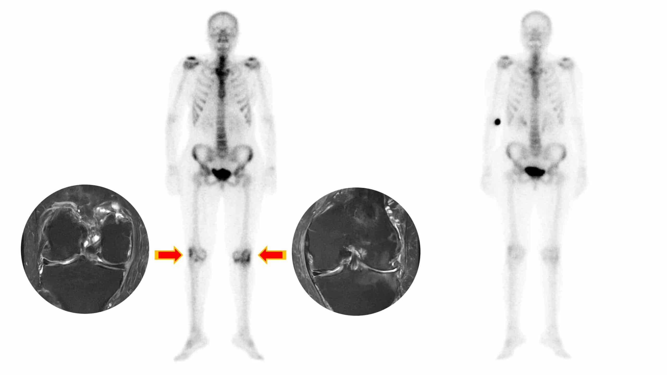 ANATOMIA DO JOELHO 33