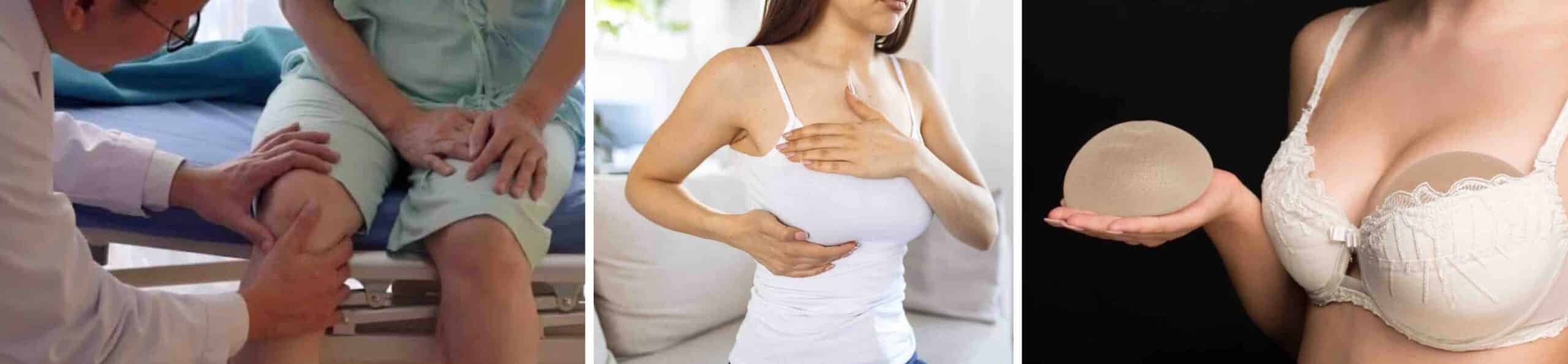 DOR JOELHO IMPLANTES MAMÁRIOS