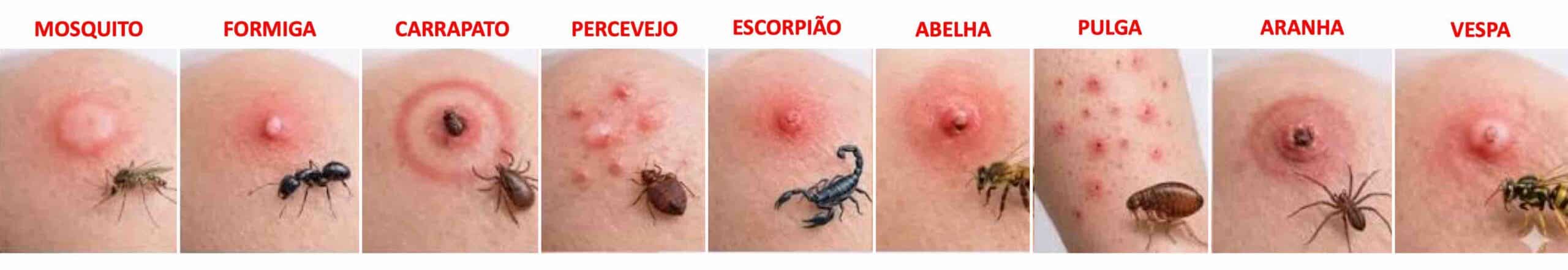 PICADA INSETO JOELHO PICADA INSETO JOELHO