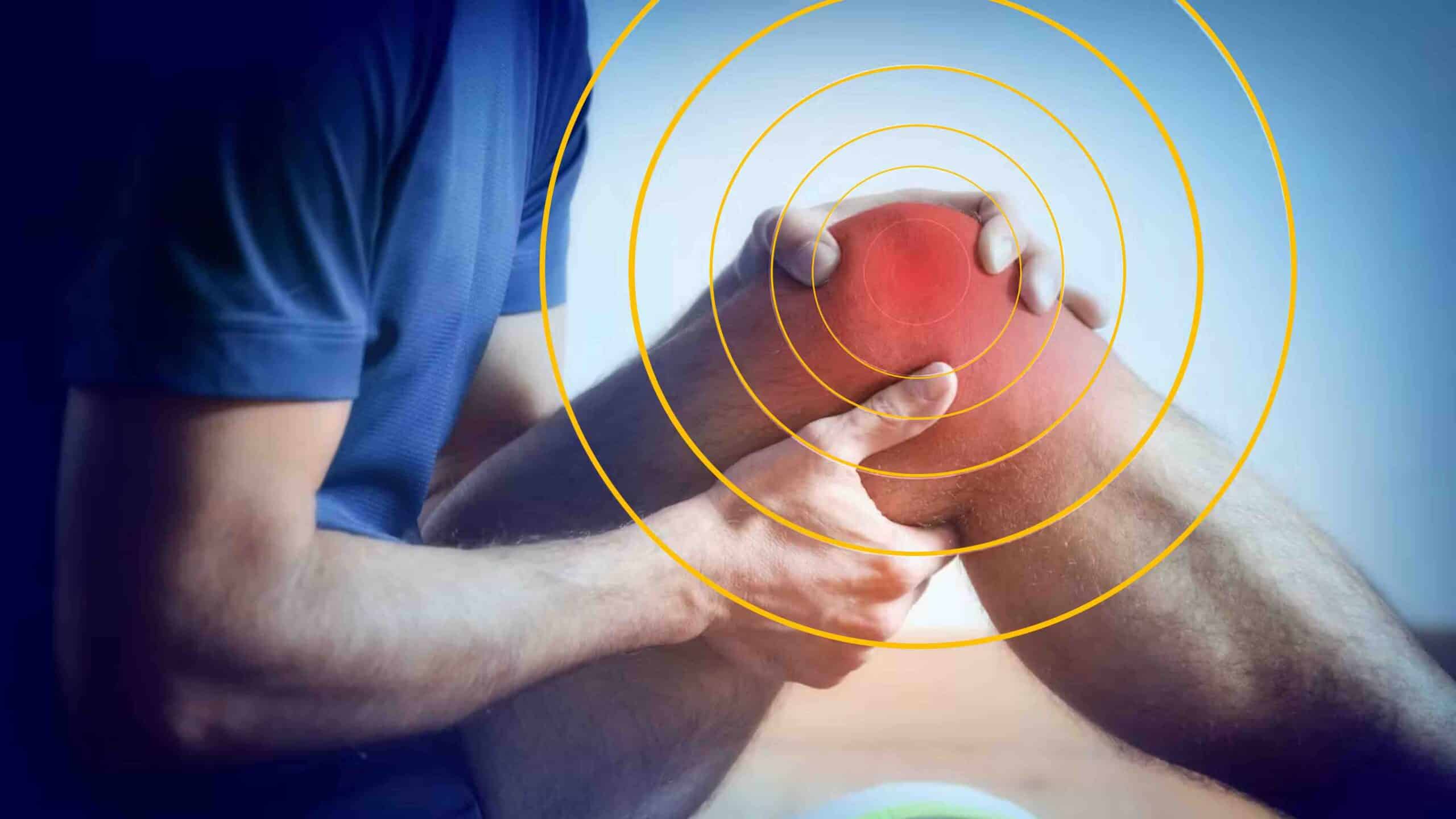 DISTROFIA SIMPÁTICO REFLEXA NO JOELHO DISTROFIA SIMPÁTICO REFLEXA NO JOELHO